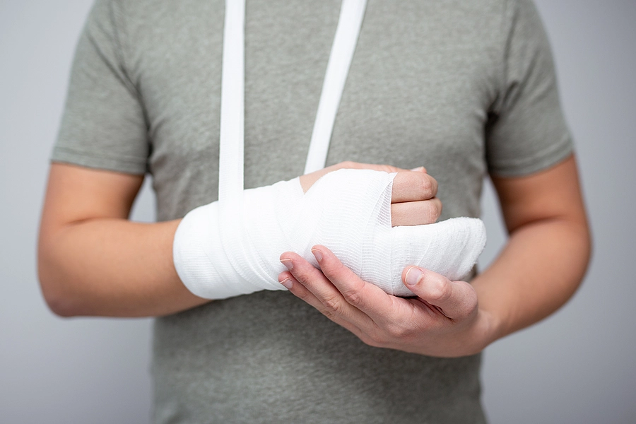 Man with broken arm in cast